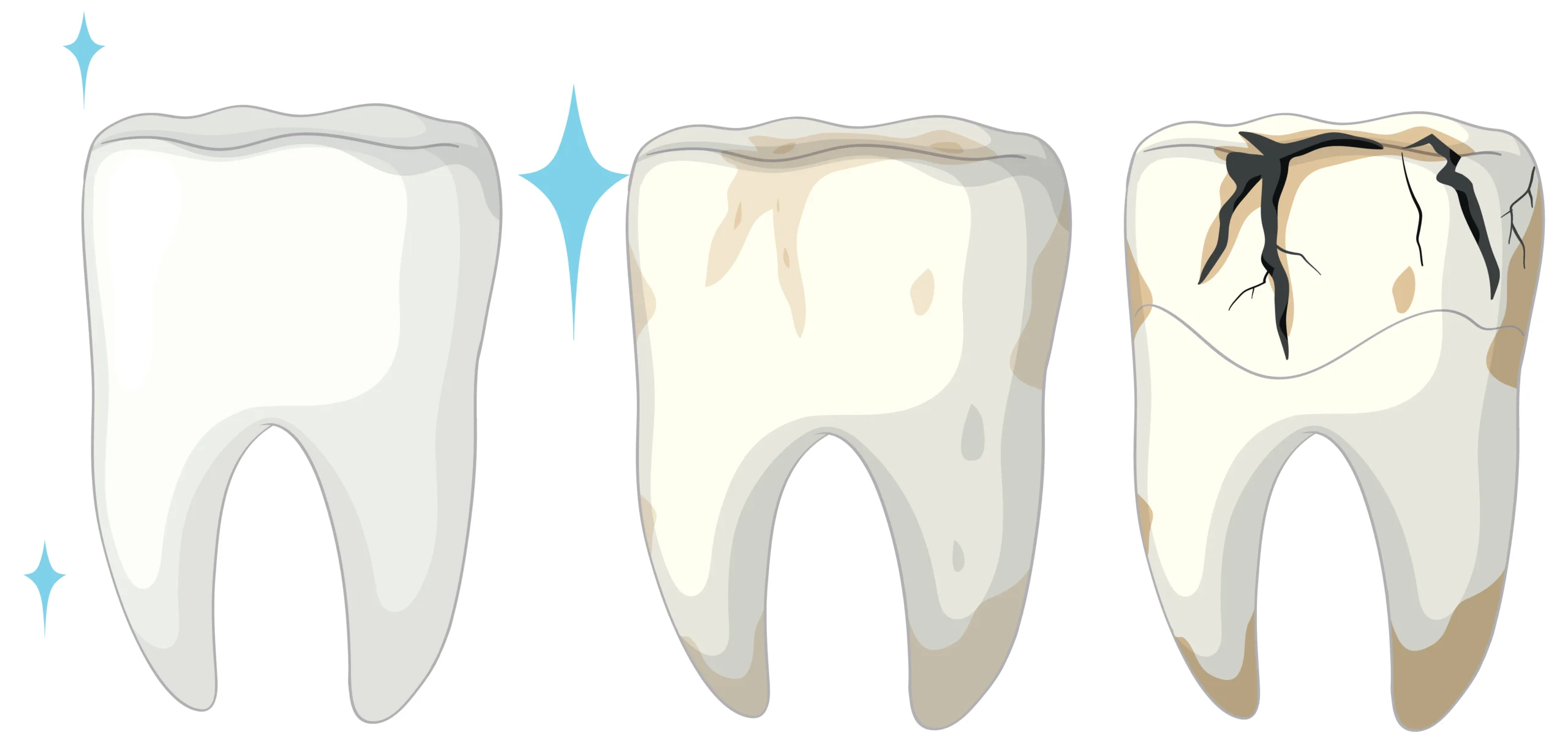 cracked tooth