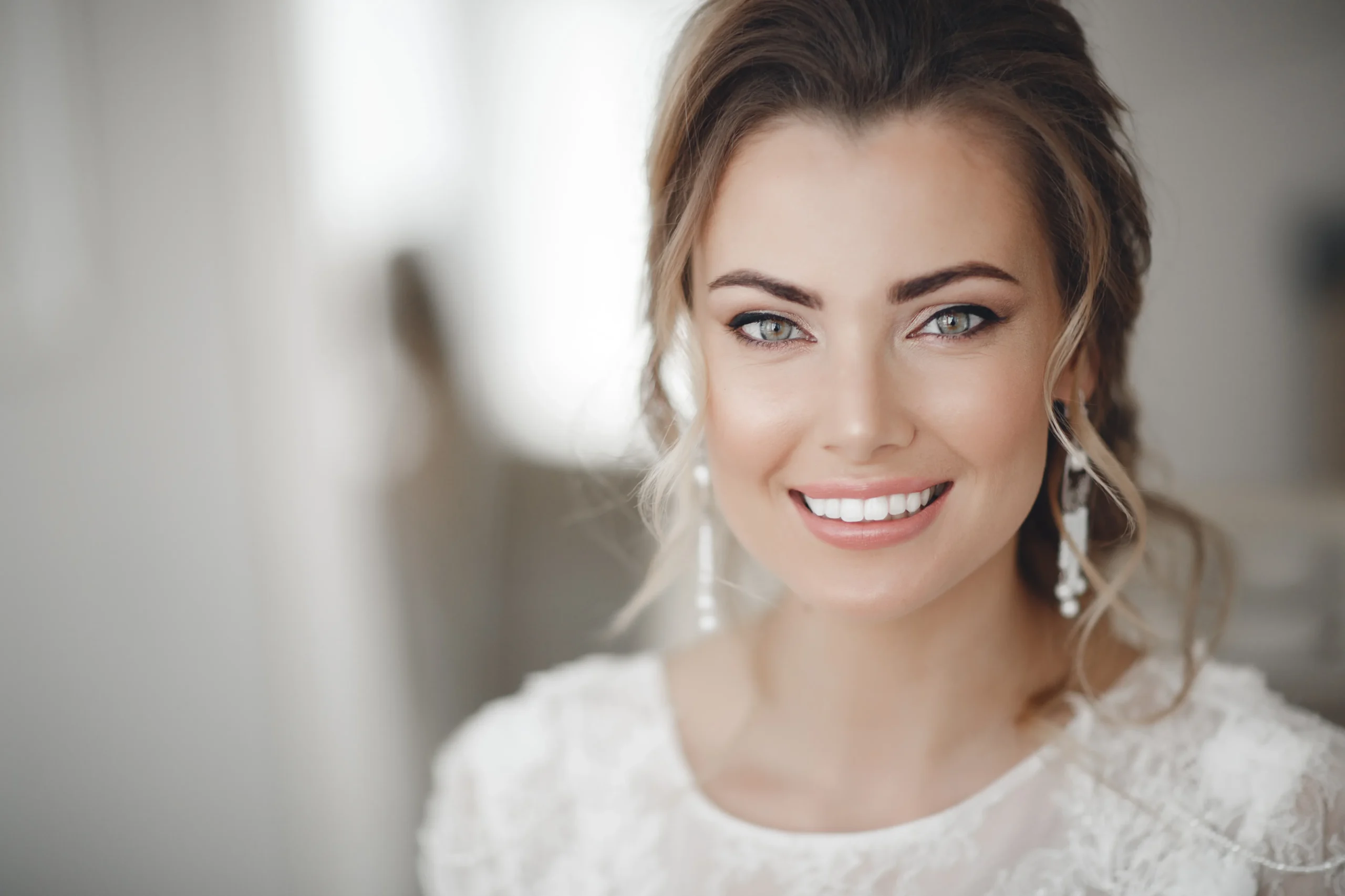 Wedding Smile Makeover