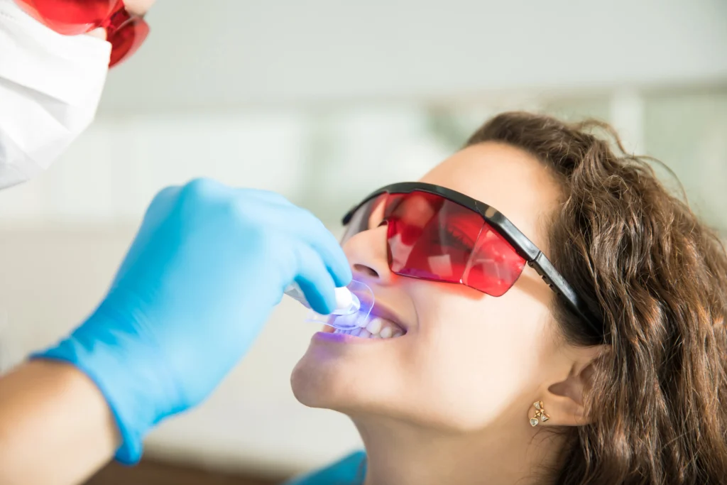 Are Teeth Whitening Strips and Kits Safe?